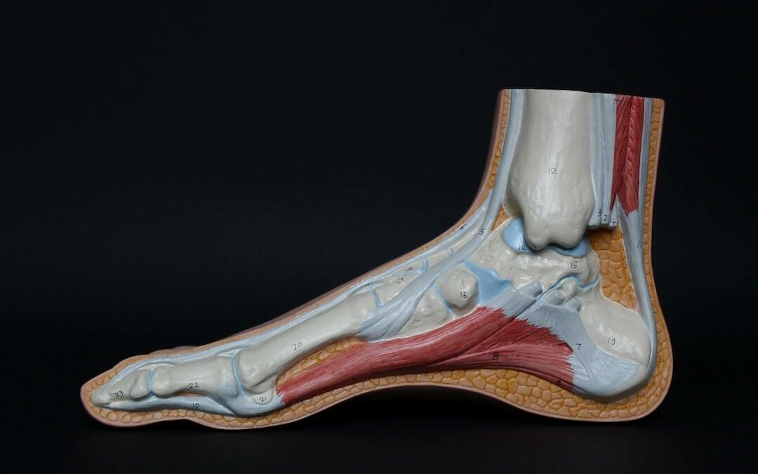 Discover 3 Ways Shockwave Therapy Helps Plantar Fasciitis